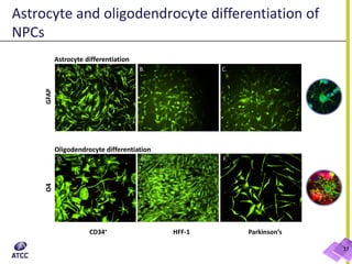 Astrocyte and oligodendrocyte differentiation of
NPCs
17
Astrocyte differentiation
Oligodendrocyte differentiation
O4
 