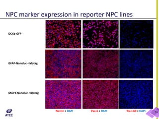 19Nestin + DAPI Pax-6 + DAPI Tra-I-60 + DAPI
DCXp-GFP
GFAP-Nanoluc-Halotag
MAP2-Nanoluc-Halotag
NPC marker expression in reporter NPC lines
 