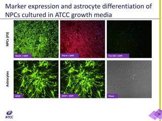 Marker expression and astrocyte differentiation of
NPCs cultured in ATCC growth media
NPCs(P3)Astrocytes
Nestin + DAPI
PhaseGFAP + DAPIGFAP
Tra-I-60 + DAPIPax-6 + DAPI
24
 