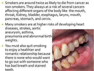  Smokers are around twice as likely to die from cancer as
non-smokers.They always at a risk of several cancers
affecting different organs of the body like the mouth,
throat, Kidney, bladder, esophagus, larynx, mouth,
pancreas, stomach, and cervix.
 Many smokers are at higher risks of developing heart
diseases, strokes, aortic
aneurysm, asthma,
pneumonia and abnormal birth
weights.
 You must also quit smoking
to enjoy a healthier and
romantic relationship because
there is none who would want
to go out with someone who
has bad breath and stained
teeth.
 