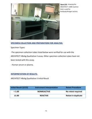 23
SPECIMEN COLLECTION AND PREPARATIOM FOR ANALYSIS:
Specimen Types:
-The specimen collection tubes listed below were verified for use with the
ARCHITECT HBsAg Qualitative II assay. Other specimen collection tubes have not
been tested with this assay.
- Human serum or plasma.
INTERPRETATION OF RESULTS:
ARCHITECT HBsAg Qualitative II Initial Result
Initial Result (S/CO) Instrument Interpretation Retest Procedure
< 1.00 NONREACTIVE No retest required
≥1.00 REACTIVE Retest in duplicate
Figure (14): showing the
ARCHITECT I 1000 machine
that is used for
Antibody/Antigen technic.
 