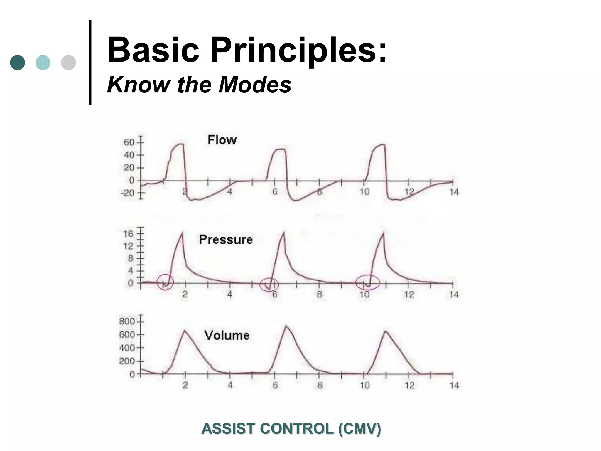 Basic Principles:
Know the Modes
ASSIST CONTROL (CMV)
 