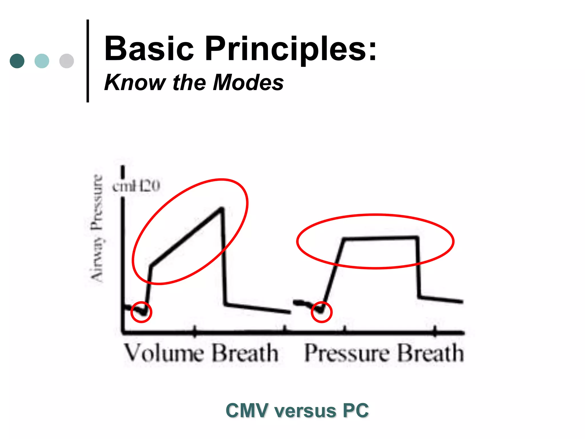 Basic Principles:
Know the Modes
CMV versus PC
 