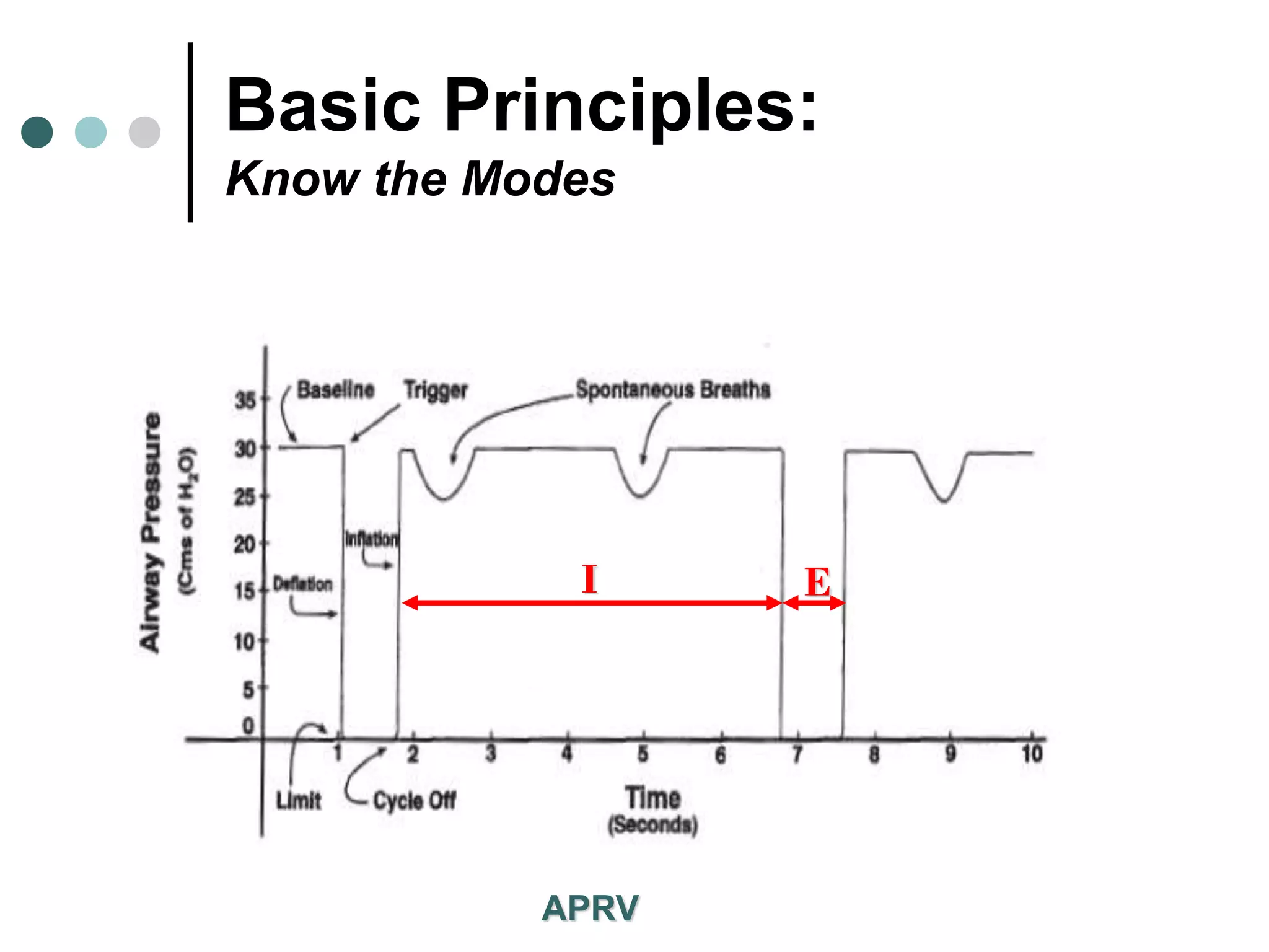 Basic Principles:
Know the Modes
APRV
I E
 