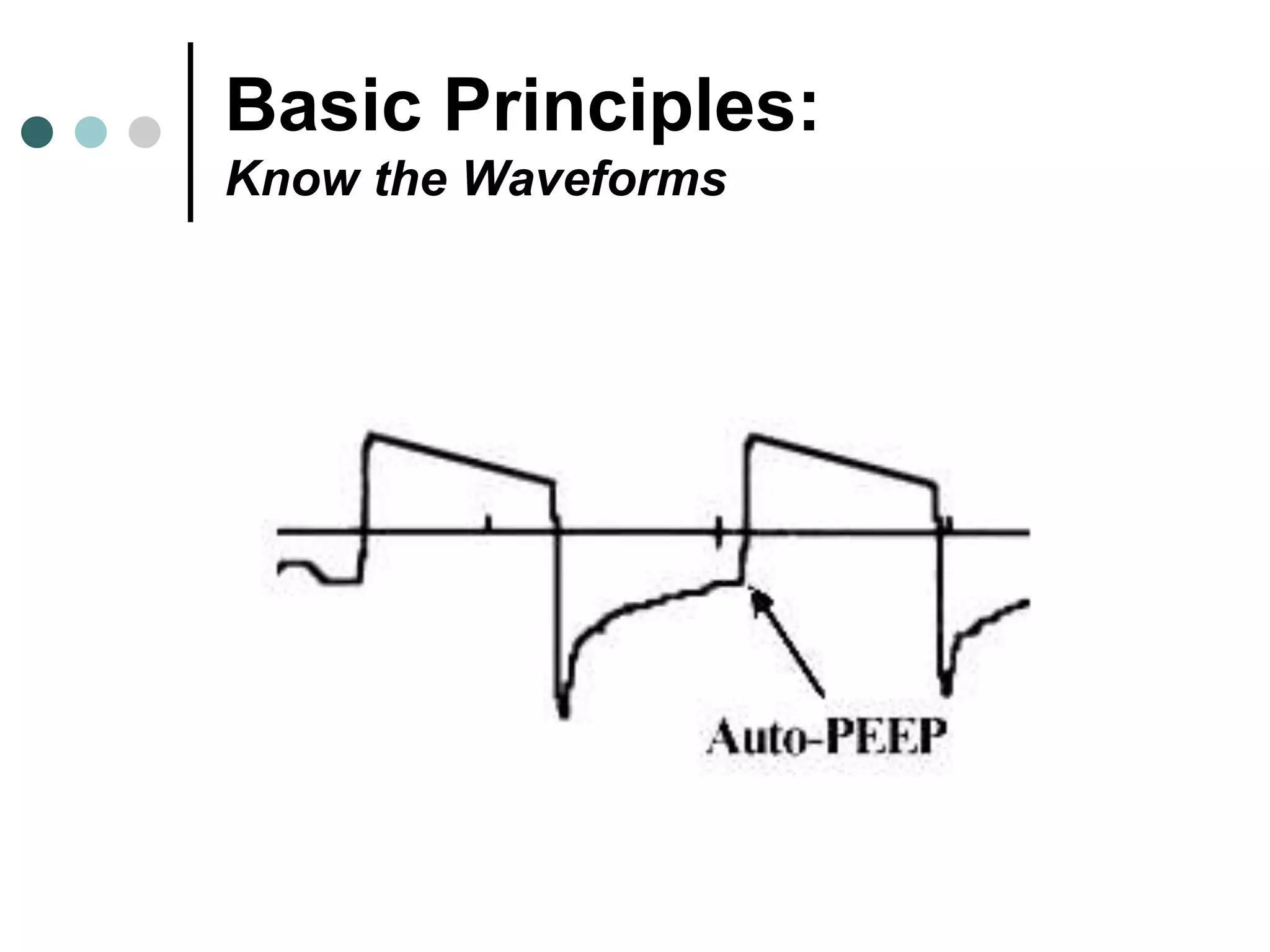 Basic Principles:
Know the Waveforms
 