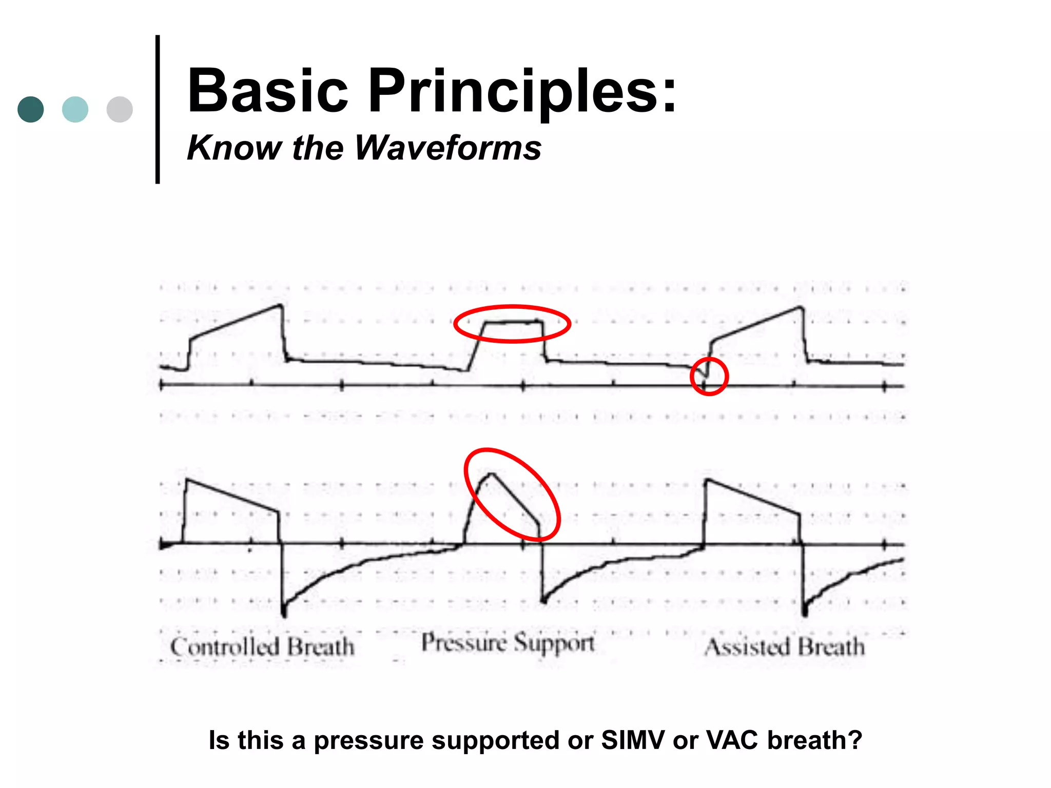 Basic Principles:
Know the Waveforms
Is this a pressure supported or SIMV or VAC breath?
 