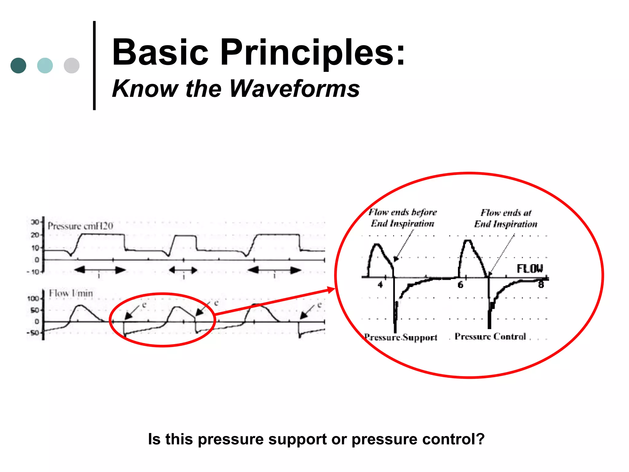 Basic Principles:
Know the Waveforms
Is this pressure support or pressure control?
 