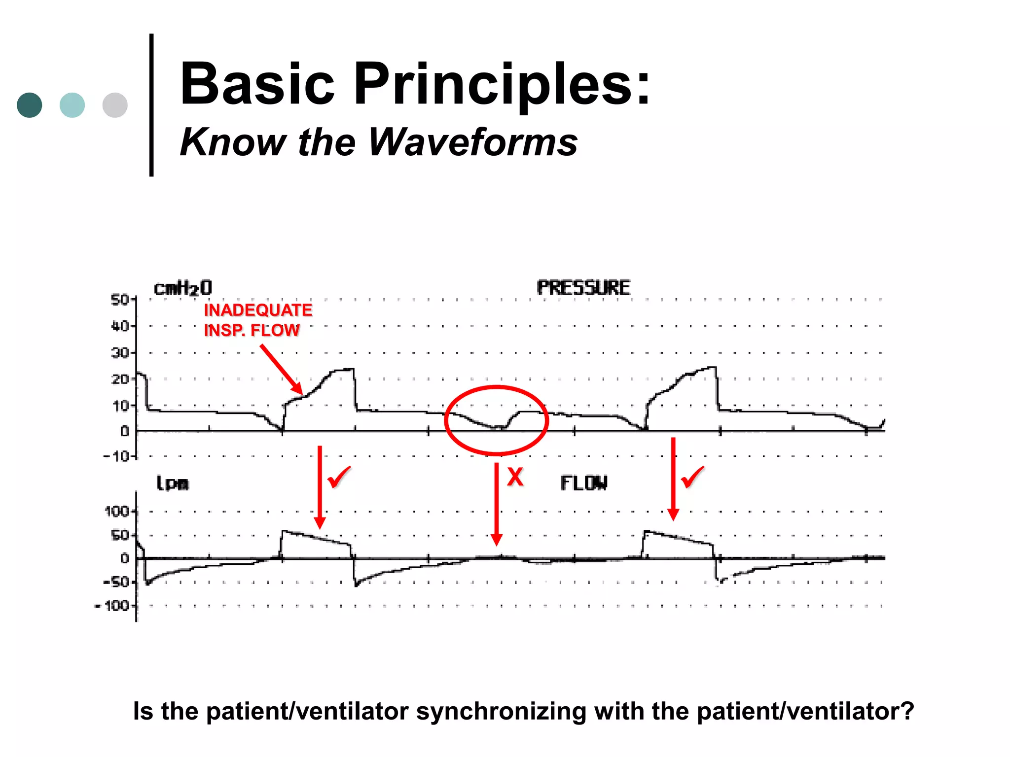 Basic Principles:
Know the Waveforms
X
INADEQUATE
INSP. FLOW
Is the patient/ventilator synchronizing with the patient/ventilator?
 