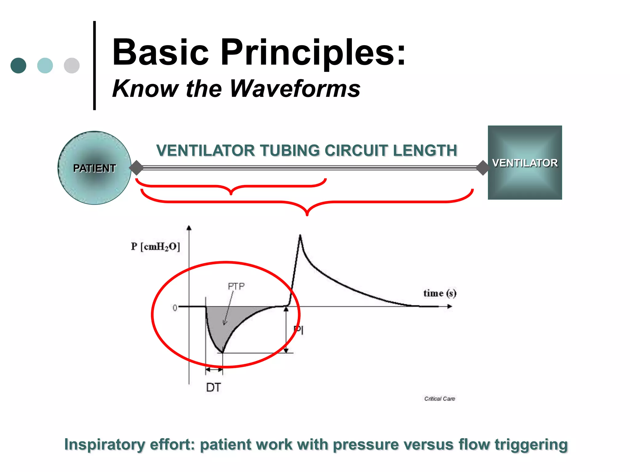 Basic Principles:
Know the Waveforms
Inspiratory effort: patient work with pressure versus flow triggering
VENTILATOR
PATIENT
VENTILATOR TUBING CIRCUIT LENGTH
 