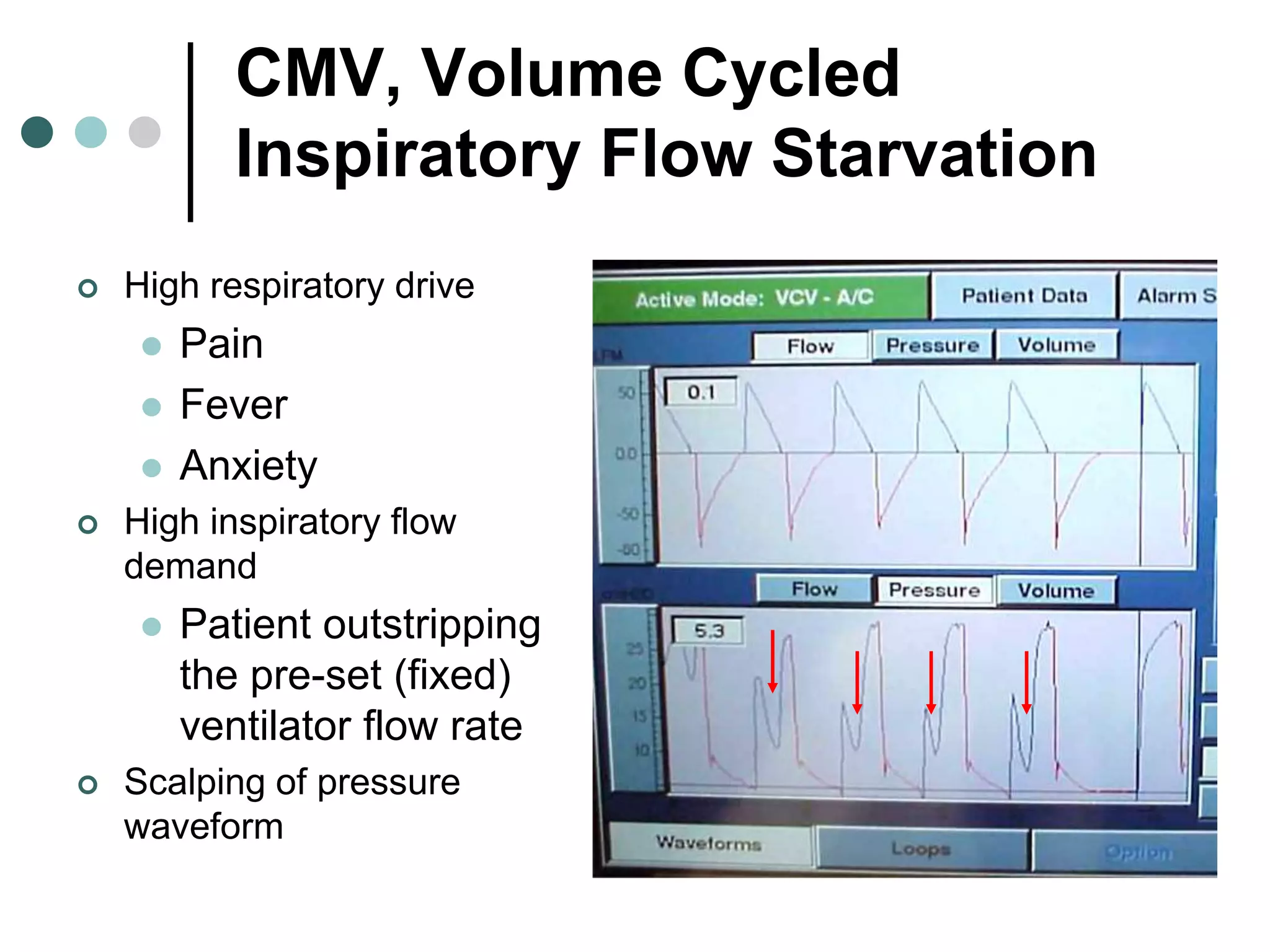 CMV, Volume Cycled
Inspiratory Flow Starvation
 High respiratory drive
 Pain
 Fever
 Anxiety
 High inspiratory flow
demand
 Patient outstripping
the pre-set (fixed)
ventilator flow rate
 Scalping of pressure
waveform
 