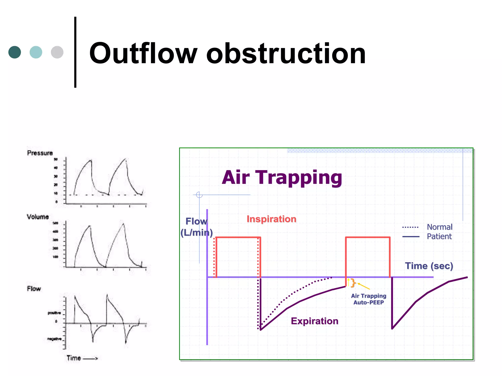 Air TrappingAir Trapping
InspirationInspiration
ExpirationExpiration
NormalNormal
PatientPatient
Time (sec)Time (sec)
Air TrappingAir Trapping
AutoAuto--PEEPPEEP
}}
FlowFlow
(L/min)(L/min)
Outflow obstruction
 