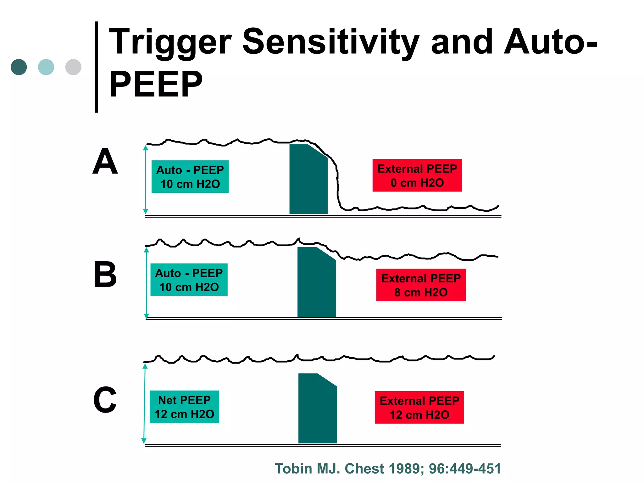 A Auto - PEEP
10 cm H2O
External PEEP
0 cm H2O
B Auto - PEEP
10 cm H2O
External PEEP
8 cm H2O
C Net PEEP
12 cm H2O
External PEEP
12 cm H2O
Tobin MJ. Chest 1989; 96:449-451
Trigger Sensitivity and Auto-
PEEP
 