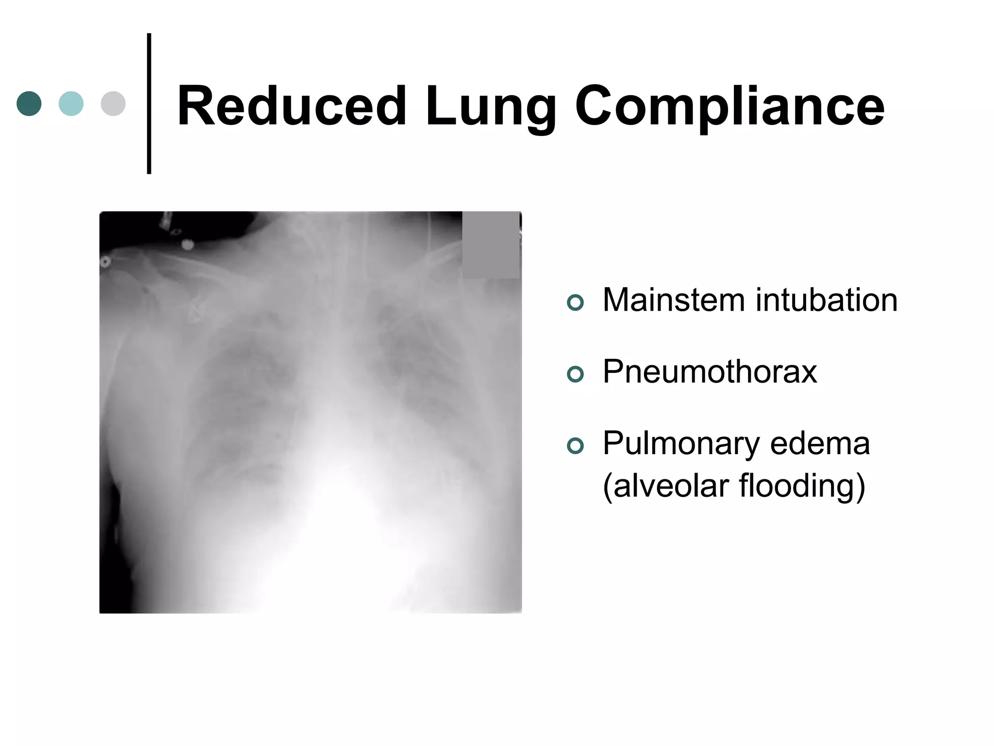 Reduced Lung Compliance
 Mainstem intubation
 Pneumothorax
 Pulmonary edema
(alveolar flooding)
 