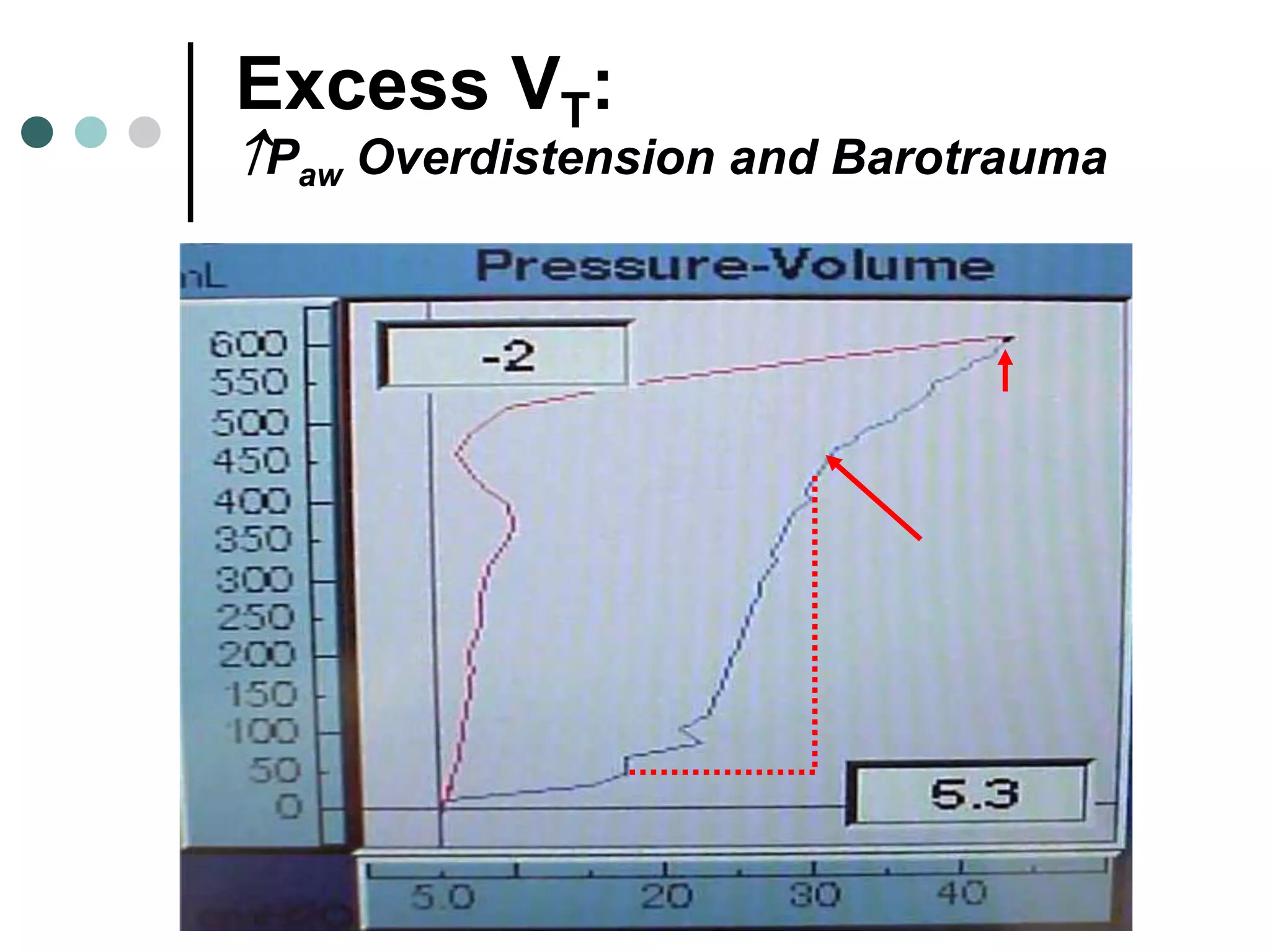 Excess VT:
Paw Overdistension and Barotrauma
 