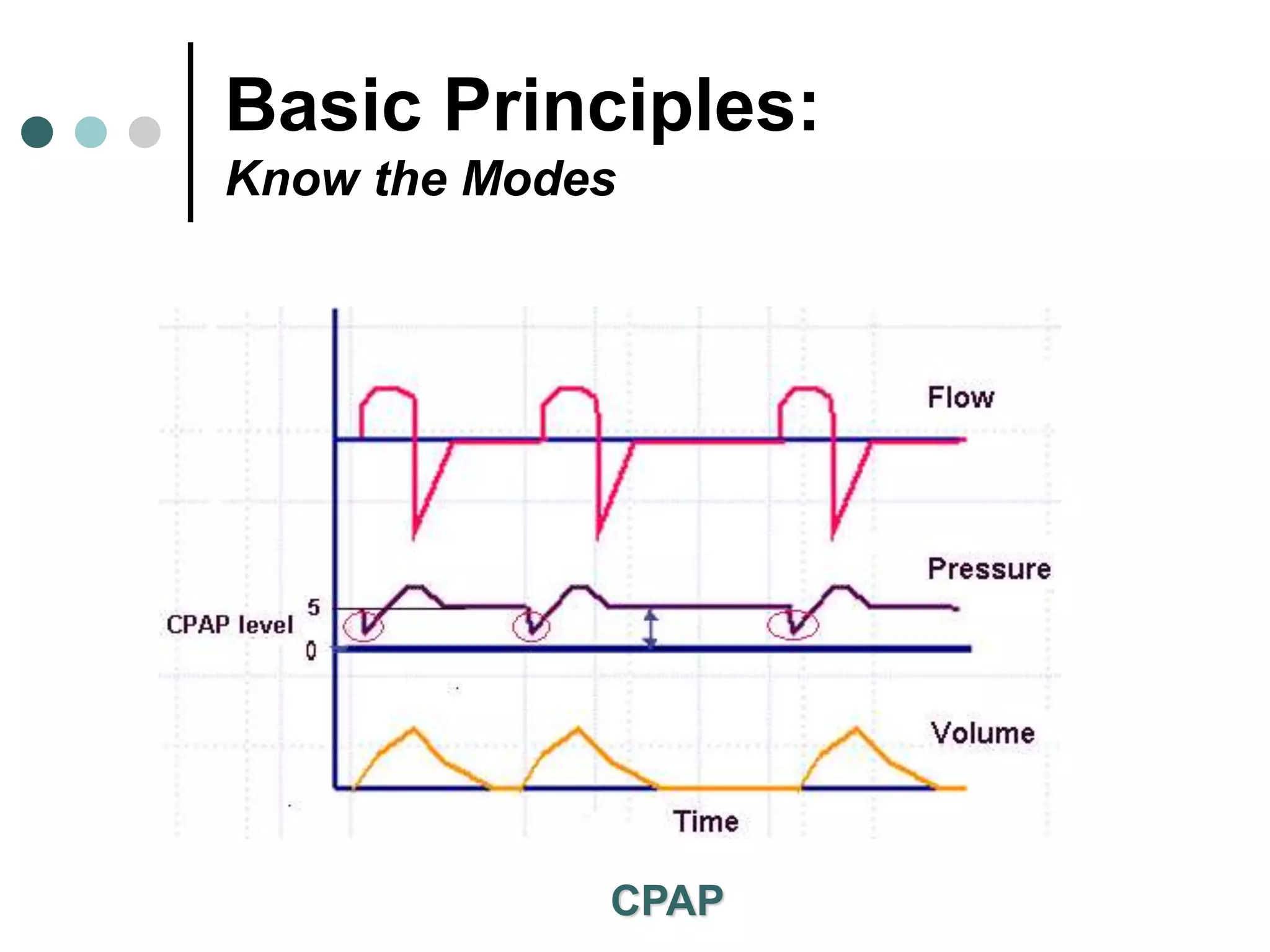 Basic Principles:
Know the Modes
CPAP
 