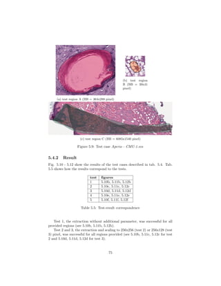 (a) test region A (BB = 364x288 pixel)
(b) test region
B (BB = 39x41
pixel)
(c) test region C (BB = 6085x1540 pixel)
Figure 5.9: Test case Aperio - CMU-1.svs
5.4.2 Result
Fig. 5.10 - 5.12 show the results of the test cases described in tab. 5.4. Tab.
5.5 shows how the results correspond to the tests.
test ﬁgures
1 5.10b, 5.11b, 5.12b
2 5.10c, 5.11c, 5.12c
3 5.10d, 5.11d, 5.12d
4 5.10e, 5.11e, 5.12e
5 5.10f, 5.11f, 5.12f
Table 5.5: Test-result correspondence
Test 1, the extraction without additional parameter, was successful for all
provided regions (see 5.10b, 5.11b, 5.12b).
Test 2 and 3, the extraction and scaling to 256x256 (test 2) or 256x128 (test
3) pixel, was successful for all regions provided (see 5.10b, 5.11c, 5.12c for test
2 and 5.10d, 5.11d, 5.12d for test 3).
75
 
