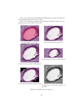 Test 4, the extraction with tessellation (32x32 pixel) was also successful for
each provided region (5.10e, 5.11e, 5.12e).
Test 5, the extraction, resizing and conversion to grayscale mode was suc-
cessful in every case (5.10f, 5.11f, 5.12f).
(a) Test region A in the ASV (b) Extracted without parameters
(c) Extracted and resized to 256x256 pixel
(d) Extracted and resized to 256x128 pixel
(e) Tessellated into 32x32 pixel sized tiles
(f) Extracted, resized and converted to
grayscale
Figure 5.10: Results for test region A
76
 