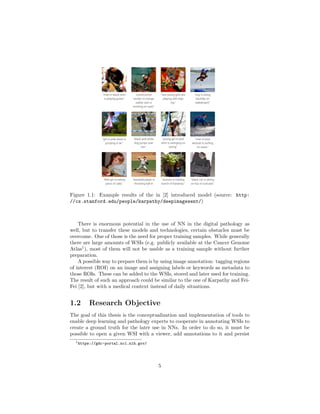Figure 1.1: Example results of the in [2] introduced model (source: http:
//cs.stanford.edu/people/karpathy/deepimagesent/)
There is enormous potential in the use of NN in the digital pathology as
well, but to transfer these models and technologies, certain obstacles must be
overcome. One of those is the need for proper training samples. While generally
there are large amounts of WSIs (e.g. publicly available at the Cancer Genome
Atlas1
), most of them will not be usable as a training sample without further
preparation.
A possible way to prepare them is by using image annotation: tagging regions
of interest (ROI) on an image and assigning labels or keywords as metadata to
those ROIs. These can be added to the WSIs, stored and later used for training.
The result of such an approach could be similar to the one of Karpathy and Fei-
Fei [2], but with a medical context instead of daily situations.
1.2 Research Objective
The goal of this thesis is the conceptualization and implementation of tools to
enable deep learning and pathology experts to cooperate in annotating WSIs to
create a ground truth for the later use in NNs. In order to do so, it must be
possible to open a given WSI with a viewer, add annotations to it and persist
1https://gdc-portal.nci.nih.gov/
5
 