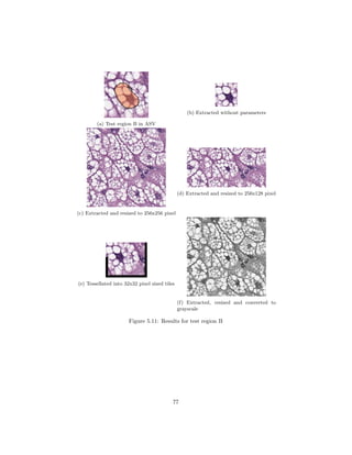 (a) Test region B in ASV
(b) Extracted without parameters
(c) Extracted and resized to 256x256 pixel
(d) Extracted and resized to 256x128 pixel
(e) Tessellated into 32x32 pixel sized tiles
(f) Extracted, resized and converted to
grayscale
Figure 5.11: Results for test region B
77
 