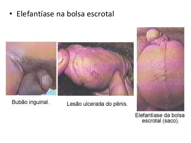 Bom significa contra parasitas