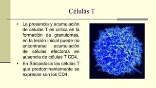 Células T
• La presencia y acumulación
de células T es critica en la
formación de granulomas,
en la lesión inicial puede no
encontrarse acumulación
de células efectoras en
ausencia de células T CD4.
• En Sarcoidosis las células T
que predominantemente se
expresan son los CD4.
 