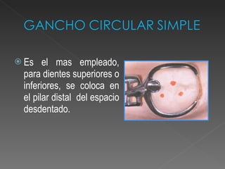 Es el mas empleado, para dientes superiores o inferiores, se coloca en el pilar distal  del espacio desdentado. 