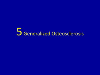 5Generalized Osteosclerosis
 