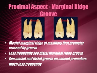Option A Distal Marginal Ridge Maxillary Premolars | PPT