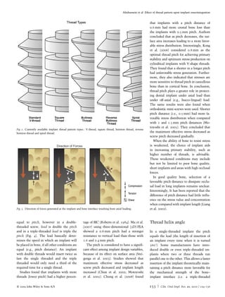Effect of thread pattern upon osseointegration | PDF