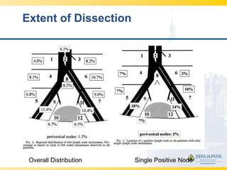 Extent of Dissection




 Overall Distribution   Single Positive Node
 