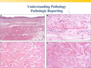 Understanding Pathology
 Pathologic Reporting
 