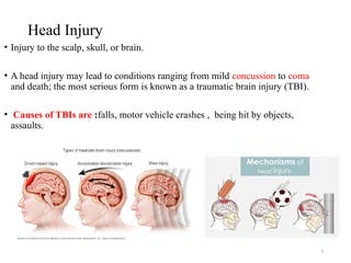 5 Head injury (1)[1]_425974386d4d442b6ce092649f8d5b41.pptx