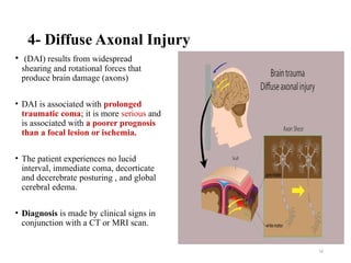 5 Head injury (1)[1]_425974386d4d442b6ce092649f8d5b41.pptx