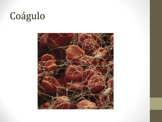 Coágulo
 