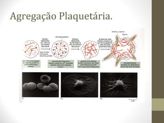 Agregação Plaquetária.
 