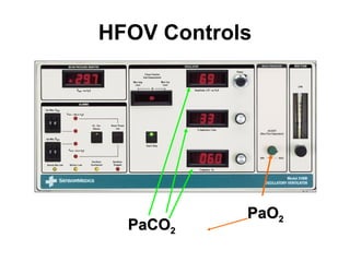 HFOV Controls PaO 2 PaCO 2 