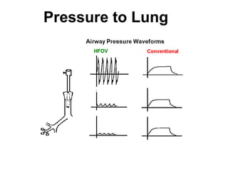 Pressure to Lung 