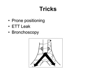 Tricks Prone positioning ETT Leak Bronchoscopy 