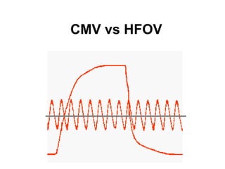 CMV vs HFOV 