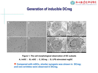 Generation of inducible DCreg
A, imDC ； B, mDC ； C, DCreg ； D, LPS stimulated regDC
Figure 1. The cell morphological observation of DC subsets
 Compared with mDCs, shorter synapsis was shown in DCreg;
and rare wrinkles were observed in DCreg.
 