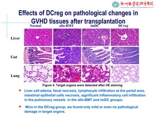 Effects of DCreg on pathological changes in
GVHD tissues after transplantation
 Liver cell edema, focal necrosis, lymphocyte infiltration at the portal area,
intestinal epithelial cells necrosis, significant inflammatory cell infiltration
in the pulmonary vessels in the allo-BMT and imDC groups;
 Mice in the DCreg group, we found only mild or even no pathological
damage in target organs.
Normal allo-BMT imDC DCreg
Liver
Gut
Lung
Figure 4. Target organs were detected after HE staining
 