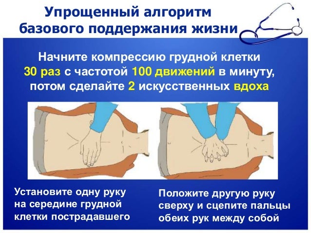Признаки закисших суппортов