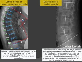 Lindblom Method Radiology& Imaging in rehabilitation.pdf
