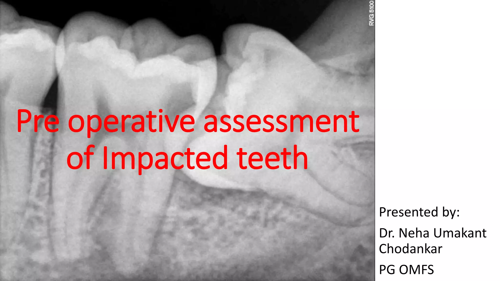 Impaction preoperative assessment.pptx