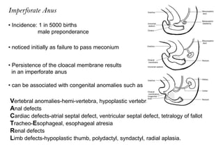 Imperforate Anus | PPTX