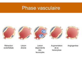 Phase vasculaire Rétraction endothéliale Lésion directe Lésion dépendente des  leucocytes Augmentation de la  transcytose Angiogenèse 