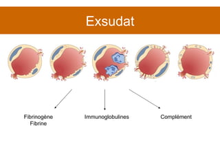 Exsudat Fibrinogène Fibrine Immunoglobulines Complément 