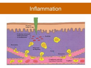 Inflammation 