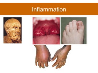Inflammation 
