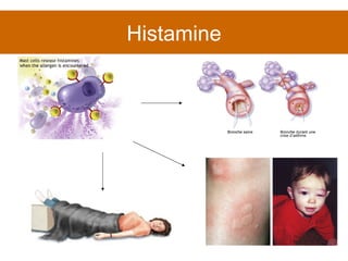 Histamine 
